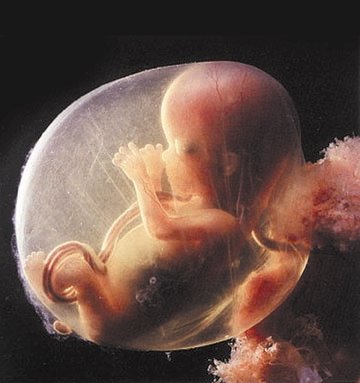aborted human fetus. Most “aborted fetuses” in